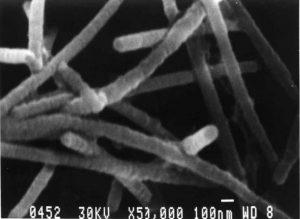 sem---nickel-nanowires-img